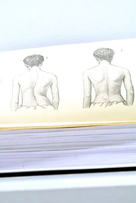 Traitement des Déviations de la Taille sans Appareils. Faits Pratiques.