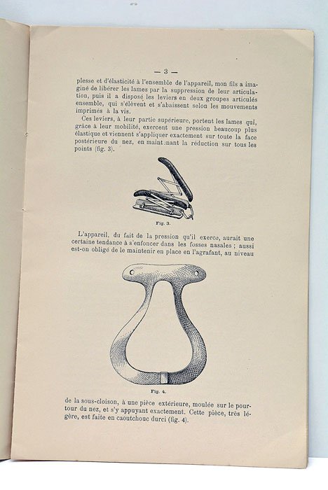 Traitement des fractures du nez.