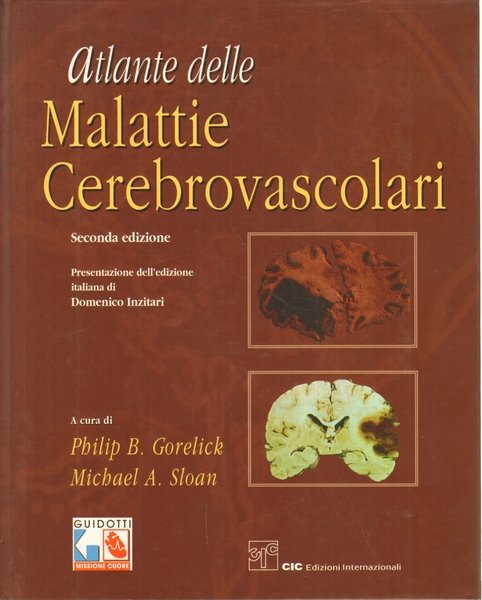 Atlante delle malattie cerebrovascolari