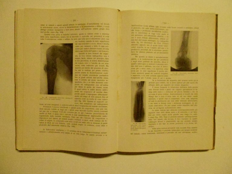 AA VV Trattato di Diagnostica Radiologica Tipografico Taddei 1928 2 …