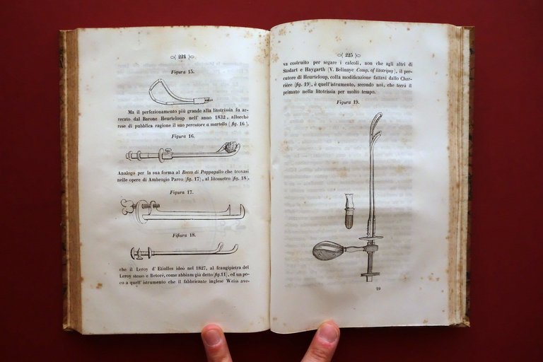 Accidenti che Possono Sopraggiungere nelle Operazioni Chirurgiche Blandin 1844 | Immagine Gallery 6