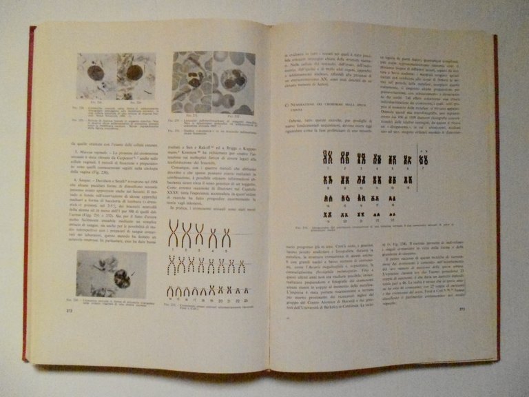 Botella Llusia Endocrinologia Donna Societ‡ Editrice Universo 1962 2 volumi | Immagine Gallery 2