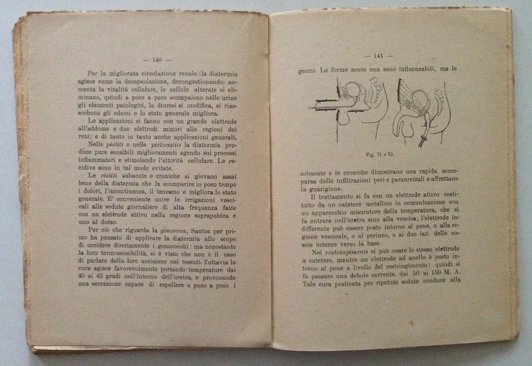 C F Zanelli Elementi di Diatermoterapia Cappelli Editore Bologna 1923