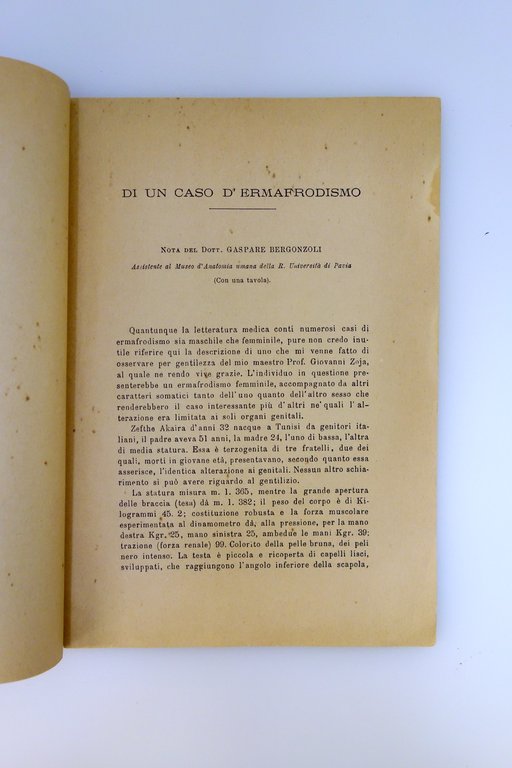 Di un Caso di Ermafroditismo Gaspare Bergonzoli Pavia 1893 con … | Immagine Gallery 2