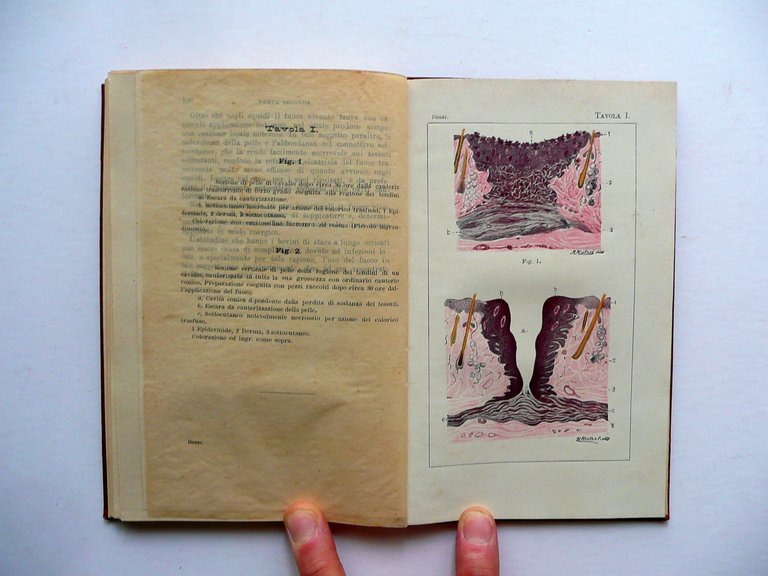 Effetti della Cauterizzazione Attuale e Guida Pratica V. Bossi Vallardi …