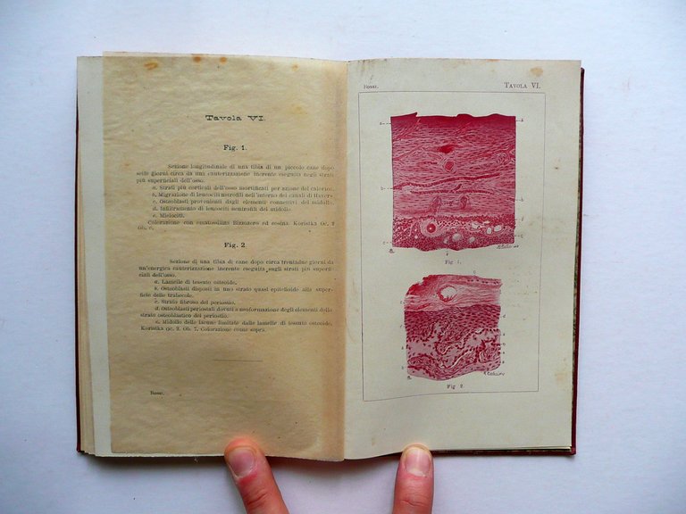 Effetti della Cauterizzazione Attuale e Guida Pratica V. Bossi Vallardi …