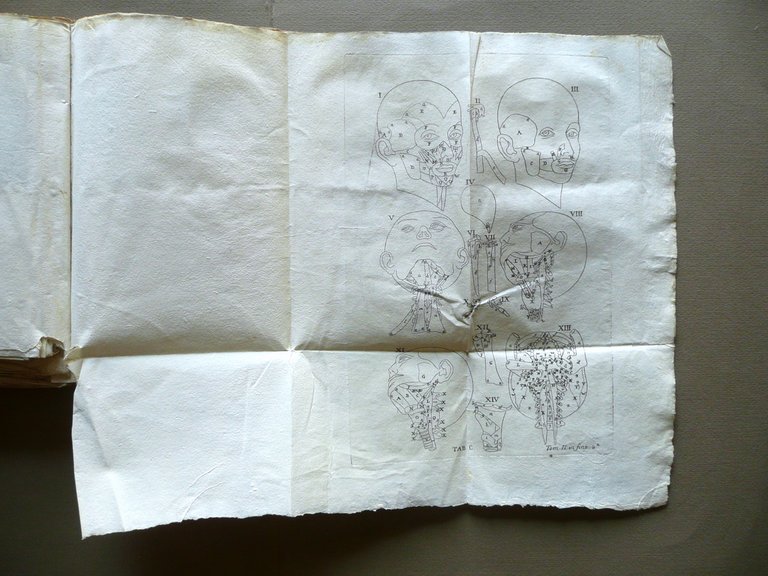 Expositio Anatomica Structurae Corporis Humani Winslow Venezia 1758 2 Volumi