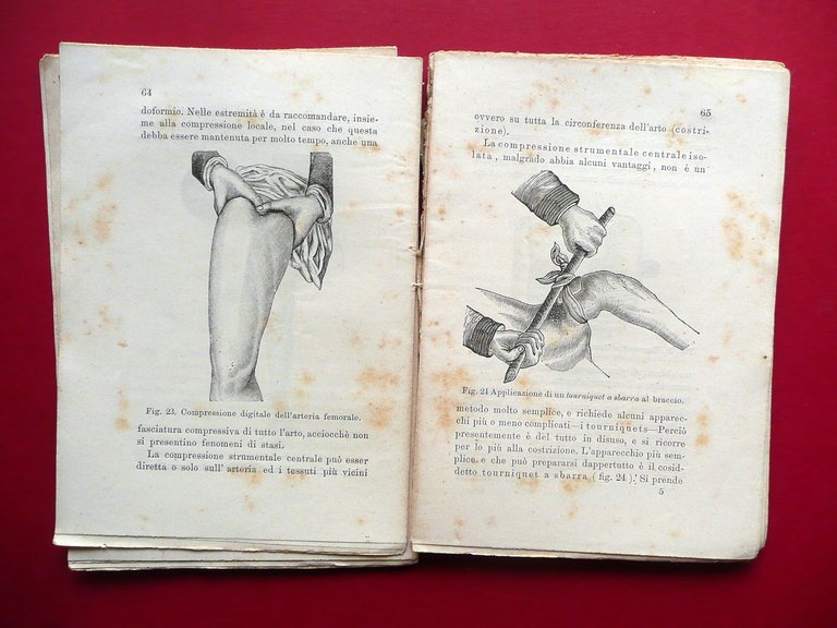 I Primi Soccorsi negli Accidenti Improvvisi R. Von Mosetig Moorhof …