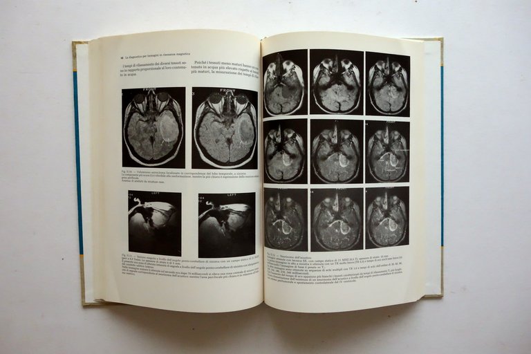 La Diagnostica per Immagini in Risonanza Magnetica Athena Roma