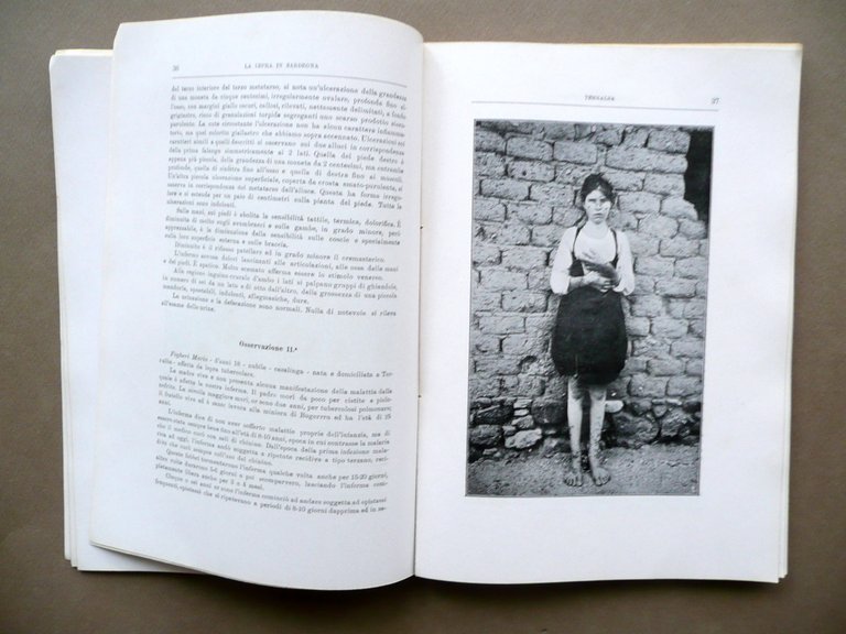 La Lepra in Sardegna Pio Colombini Alberto Serra Dessi Cagliari … | Immagine Gallery 4