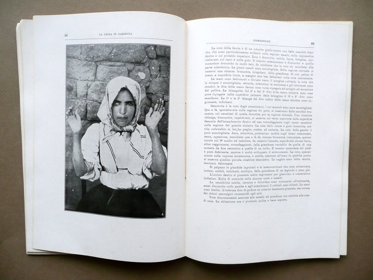 La Lepra in Sardegna Pio Colombini Alberto Serra Dessi Cagliari … | Immagine Gallery 5