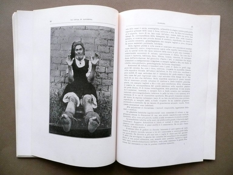 La Lepra in Sardegna Pio Colombini Alberto Serra Dessi Cagliari … | Immagine Gallery 6