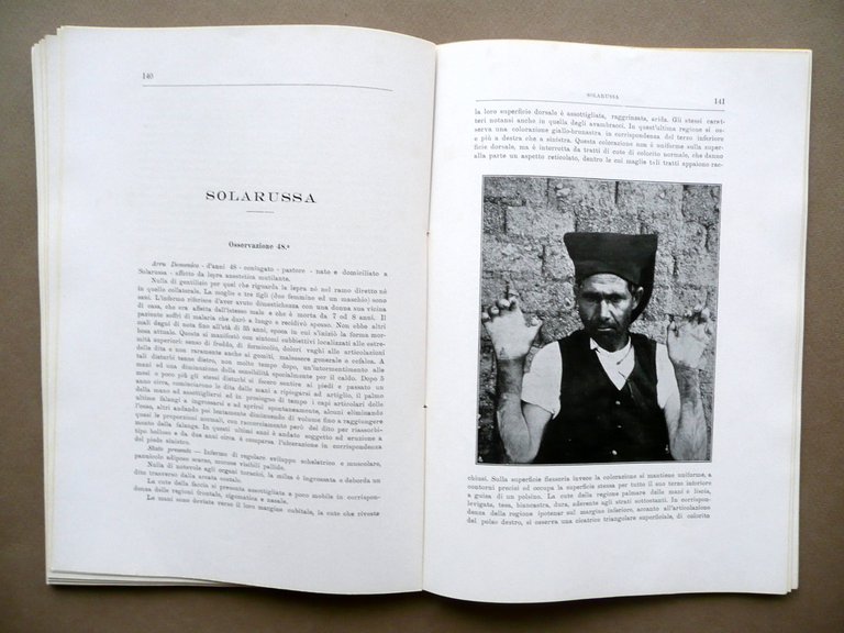 La Lepra in Sardegna Pio Colombini Alberto Serra Dessi Cagliari … | Immagine Gallery 7