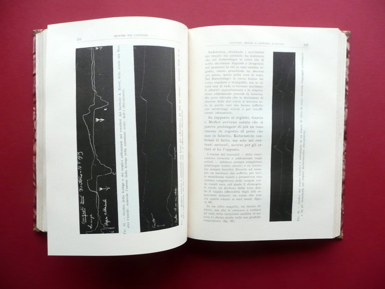 La Voce Parlata e Cantata Normale e Patologica Bilancioni Pozzi …