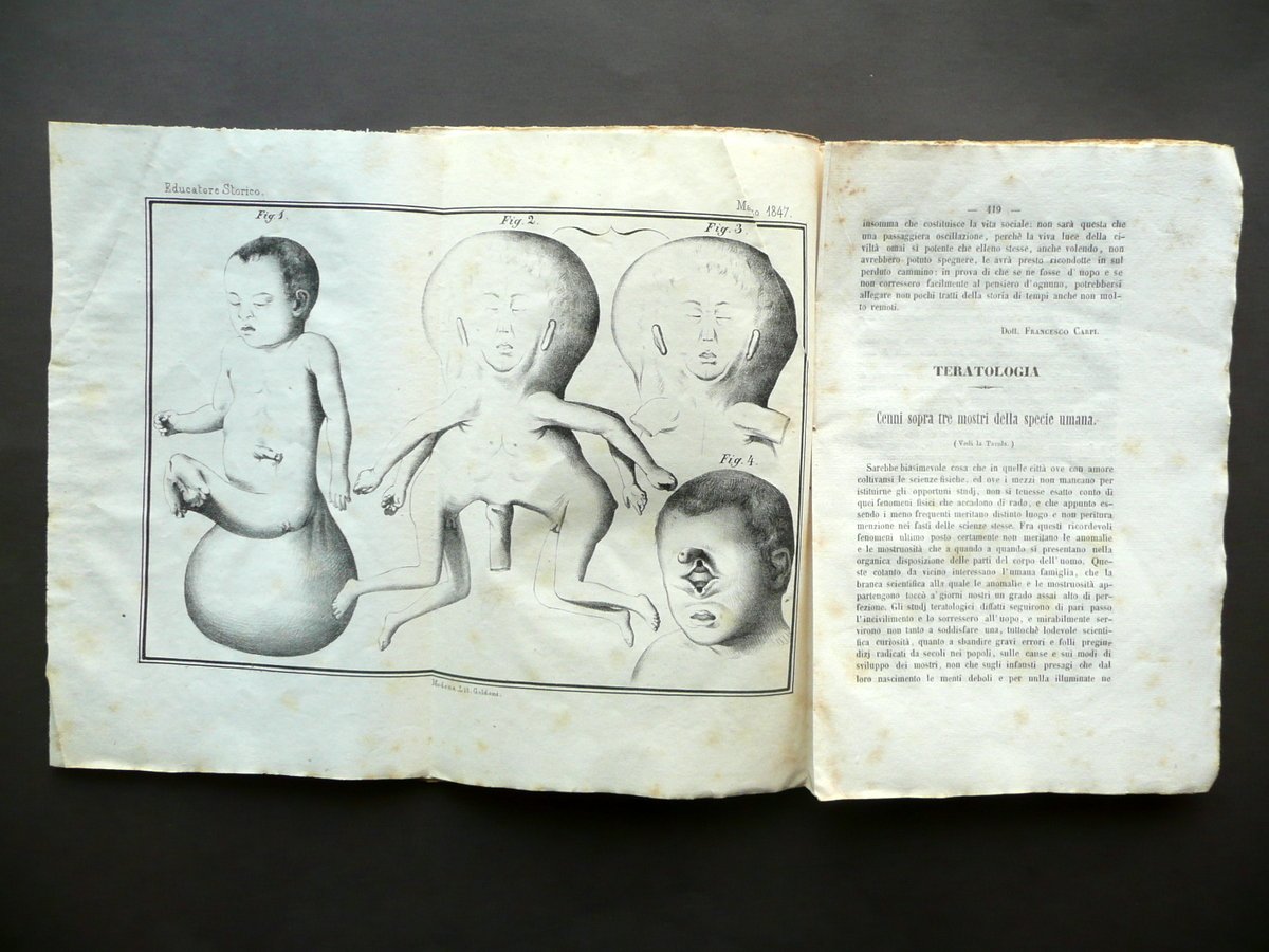 Teratologia Tre Mostri della Specie Umana Gaddi Tavola L'Educatore Storico …