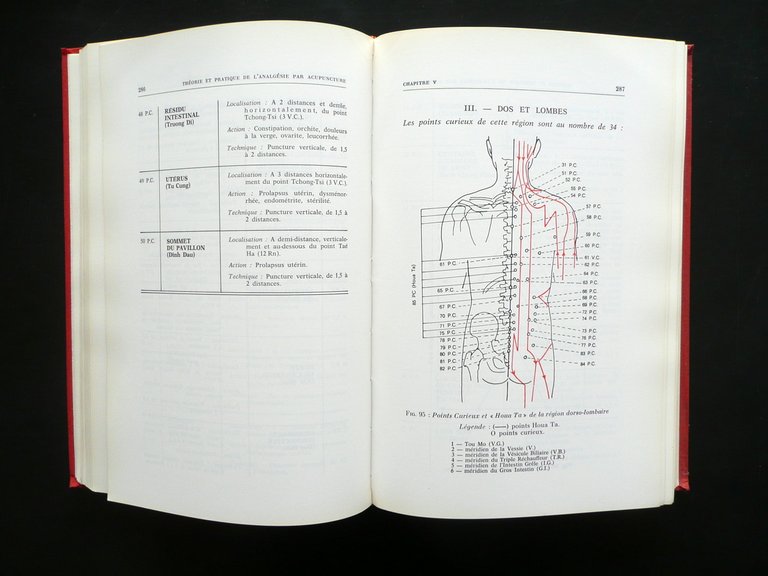Theorie et Pratique de l'Analgesie par Acupuncture SOCEDIM 1974 Agopuntura …
