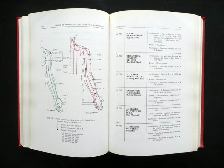 Theorie et Pratique de l'Analgesie par Acupuncture SOCEDIM 1974 Agopuntura …