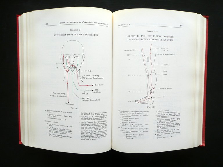 Theorie et Pratique de l'Analgesie par Acupuncture SOCEDIM 1974 Agopuntura …