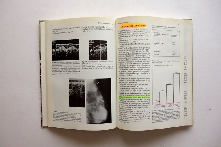 Y. Grumbach Mammografia ed Ecografia nello Studio del Seno Masson …