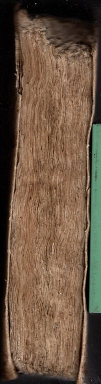 De Morbis Venereis Libri Sex 1741