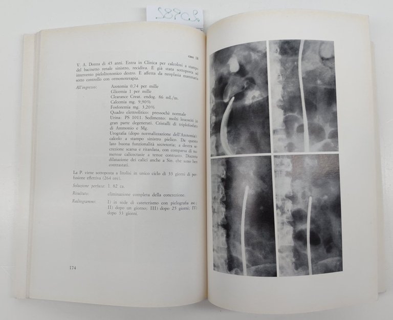 Aa.Vv. La terapia medica e litica della calcolosi urinaria 1965