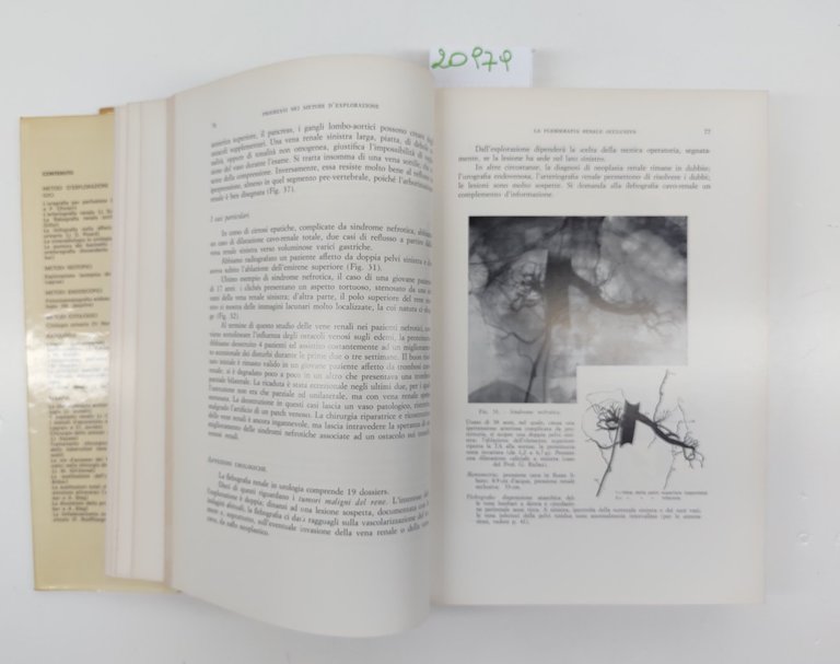 Adoulker Urologia progressi volume unico C.E.L.I. 1972
