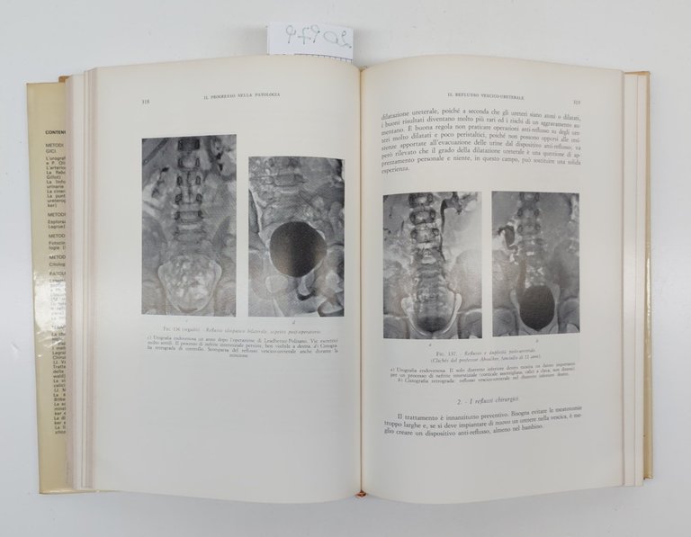 Adoulker Urologia progressi volume unico C.E.L.I. 1972