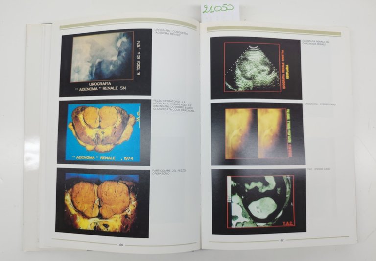 Benelli Gavazzi Oncologia urologica per immagini computerizzate Menarini 1988