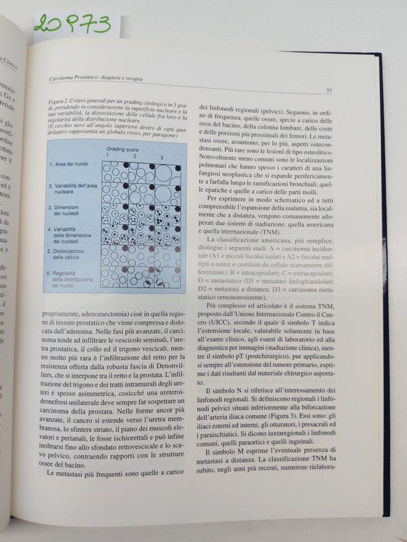 Bono Robustelli Carcinoma prostatico diagnosi e terapia Edimes 1993