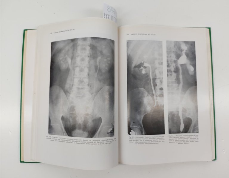 Chiaudano Sesia Radiologia della tubercolosi urinaria Minerva medica 1971