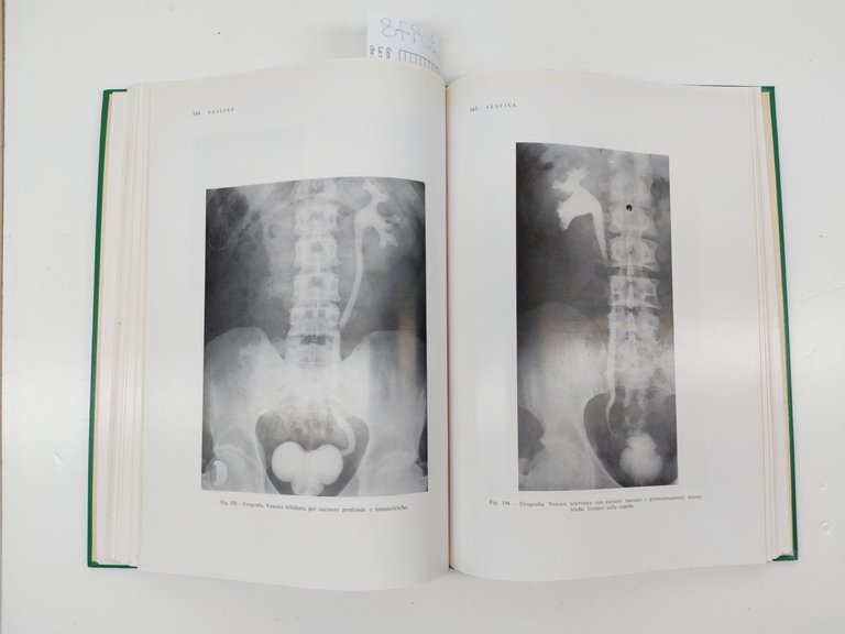 Chiaudano Sesia Radiologia della tubercolosi urinaria Minerva medica 1971