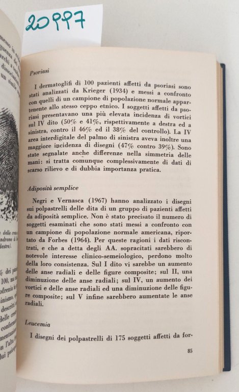 Collana monografica Zambon DallaPiccola I dermatoglifi della mano 1968