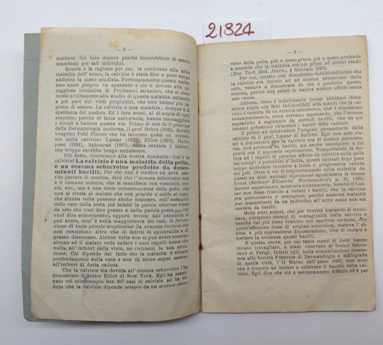 Dott Alfonso Bacciotti La caduta dei capelli e sua cura …