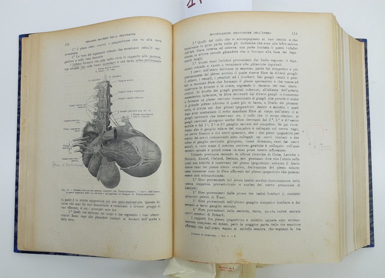 I. Clivio Trattato di ostetricia tre volumi in un unico … | Immagine Gallery 11