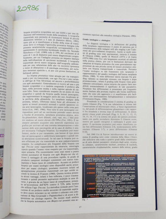 Il carcinoma della prostata per immagini Ipsen 1993