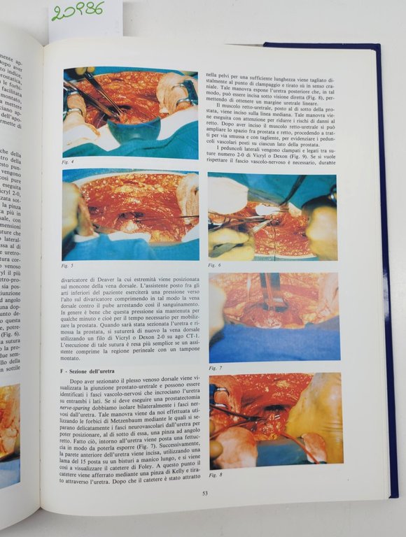 Il carcinoma della prostata per immagini Ipsen 1993