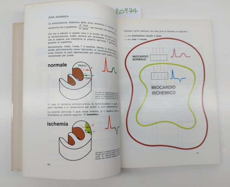 L'infarto del miocardio terapia e profilassi delle complicanze con C-tre …