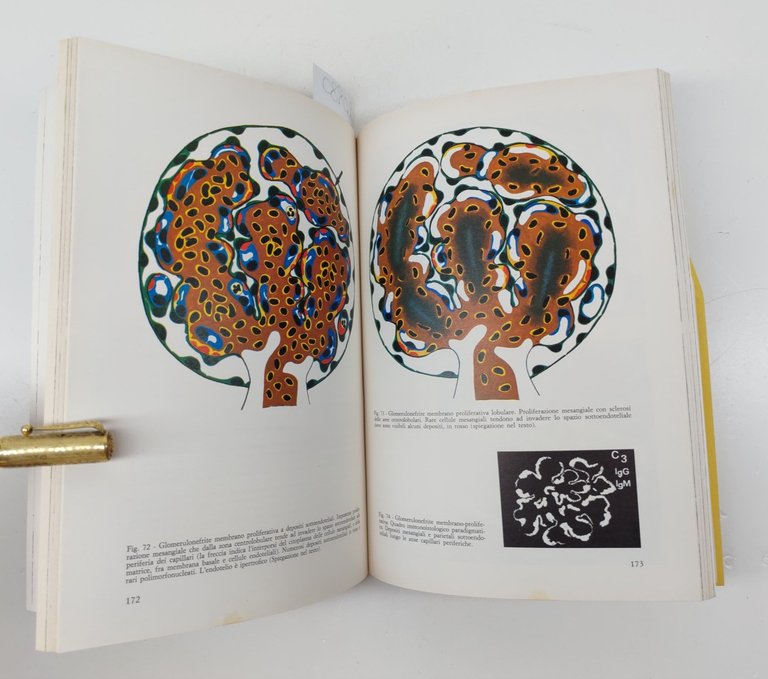 La medicina internazionale n. 24 1977 Le glomerulonefriti primitive