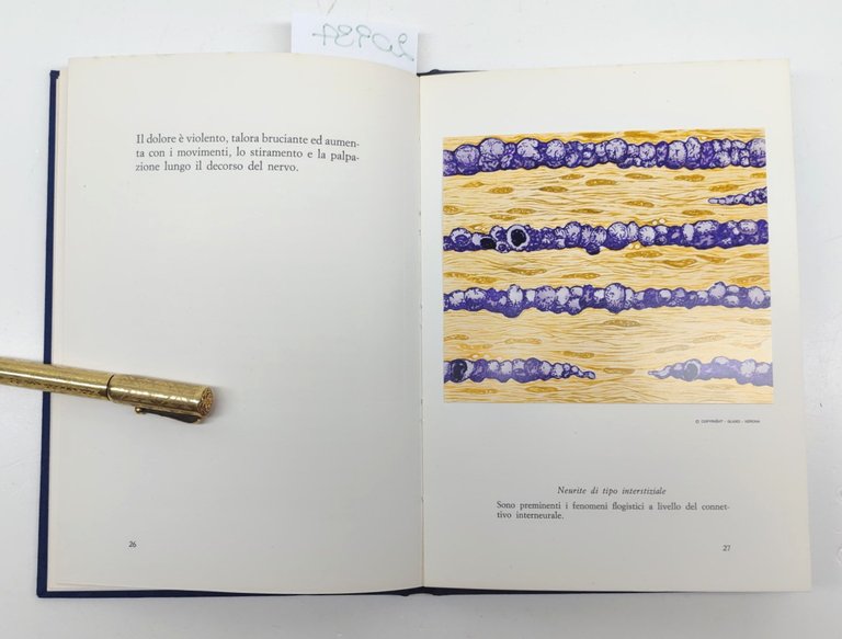 Le neuropatie periferiche aspetti patogenetici e clinico-terapeutici Laboratori Glaxo