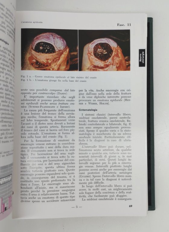 Luigi Russo Schedario di chirurgia 4 volumi 1964 copia numero …