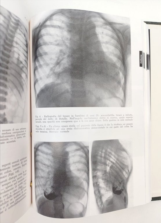 Luigi Russo Schedario di chirurgia 4 volumi 1964 copia numero …