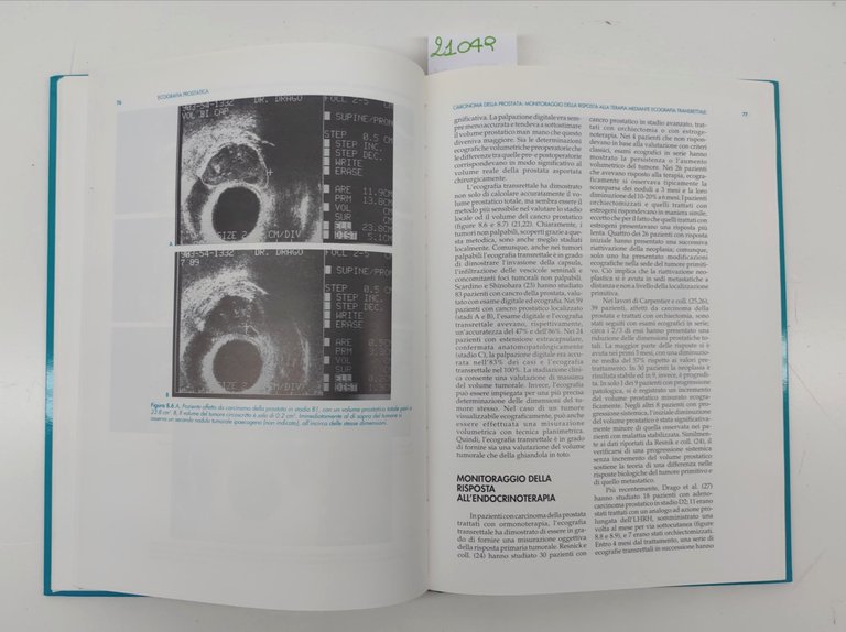 Martin Resnick L'ecografia prostatica Momento medico 1990