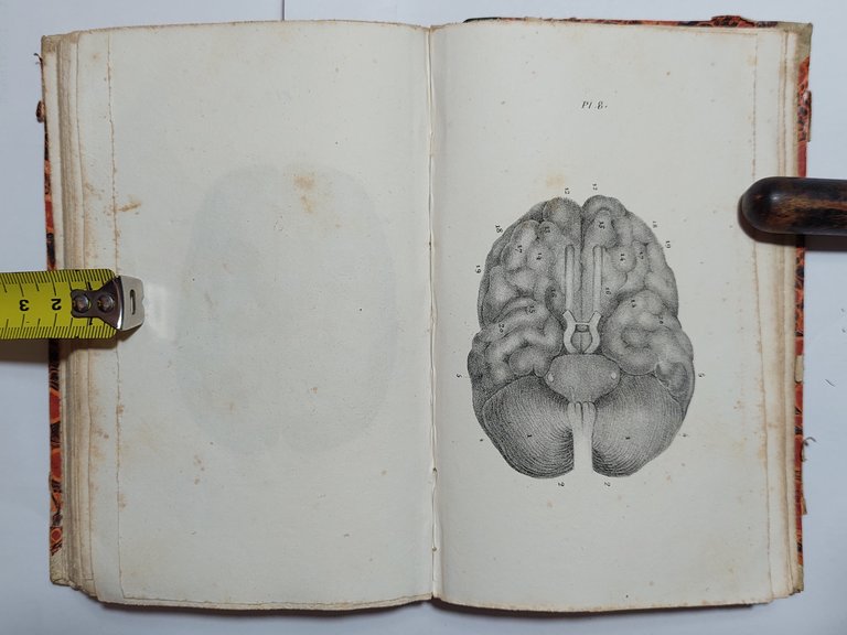 Medicina Cranioscopia Précis analytique raisonne du systeme du Docteur Gall …