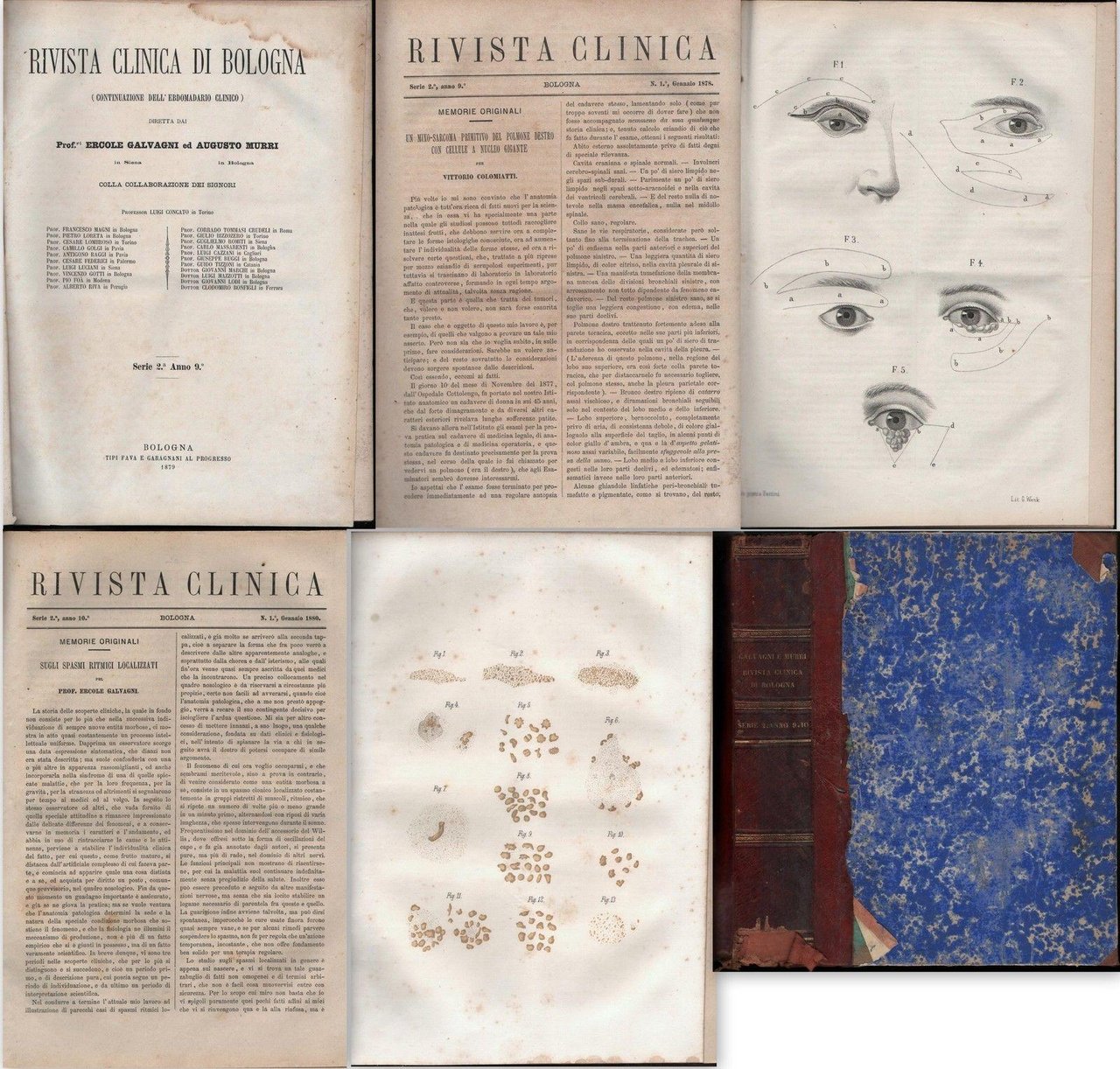 RIVISTA CLINICA DI BOLOGNA E.GALVAGNI-A.MURRI-2 ANNATE COMPLETE-1879-1880-ILLUS.