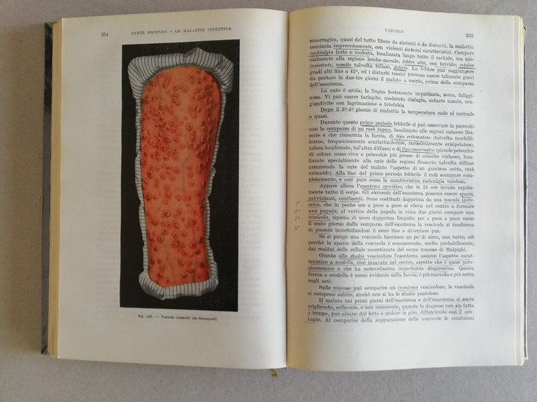 Trattato di Patologia Speciale Medica e Terapia M. Bufano P. … | Immagine Gallery 5