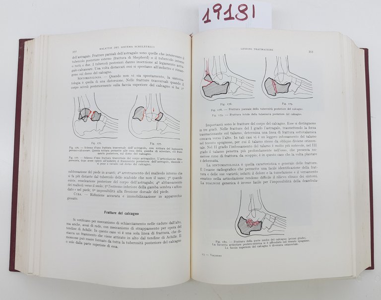 Valdoni Manuale di patologia chirurgica 3° edizione SEI 1961