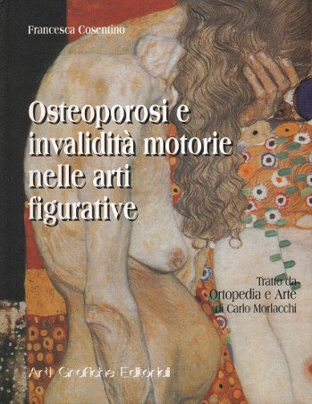OSTEOPOROSI E INVALIDITA' MOTORIE NELLE ARTI FIGURATIVE