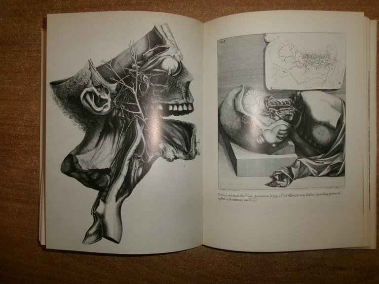 A HISTHORY of MEDICINE. BRIAN INGLIS 1965