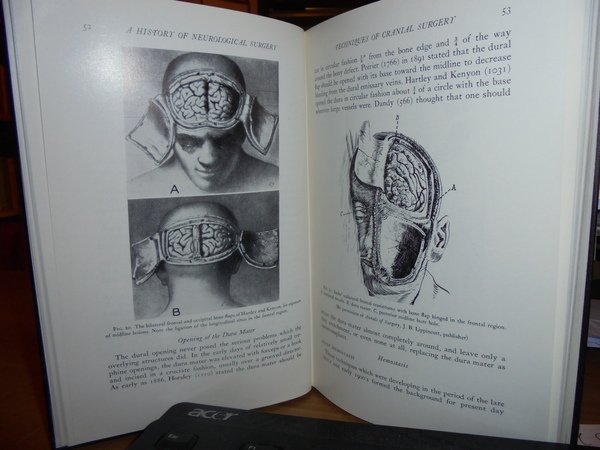 A HISTORY of NEUROLOGICAL SURGEY