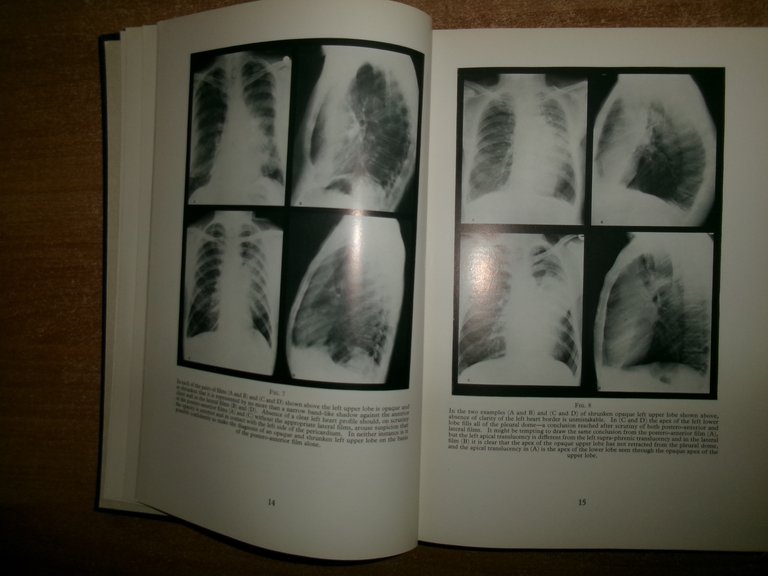 AA. VV. A Second Portfolio of Chest Radiographs for Undergraduate..LE …